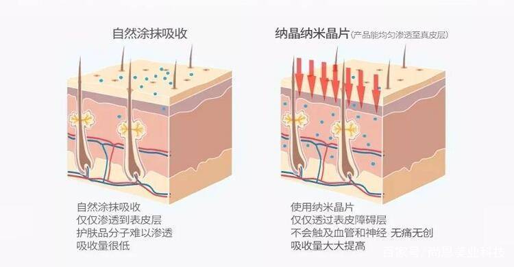 过滤棉净水有效果吗？详细解读其原理、效果及应用场景